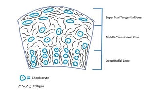 Picture of Artificial cartilage