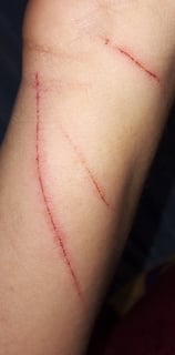 Picture of Injury