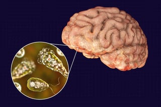 Picture of Brain-eating amoeba