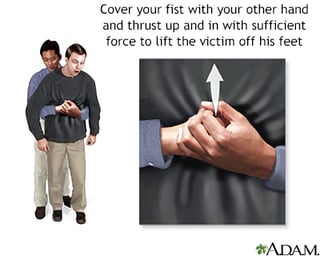Picture of Abdominal thrusts