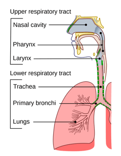 Picture of Respiratory tract infection