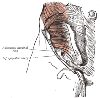 Picture of Side strain
