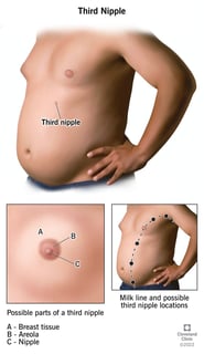 Picture of nipple