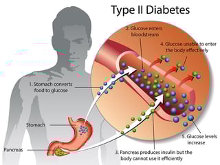 Picture of type 2 diabetes