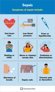 Picture of sepsis