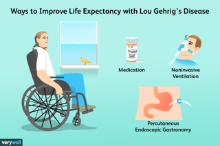 Picture of amyotrophic lateral sclerosis