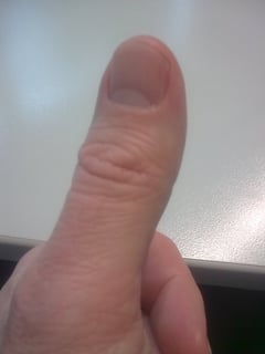 Picture of thumb