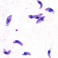 Picture of Toxoplasma gondii