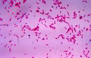 Picture of Fusobacterium