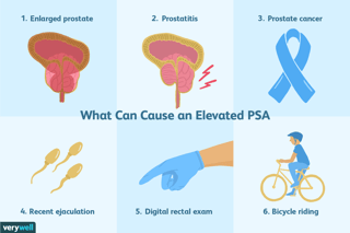 Picture of Prostate-specific antigen