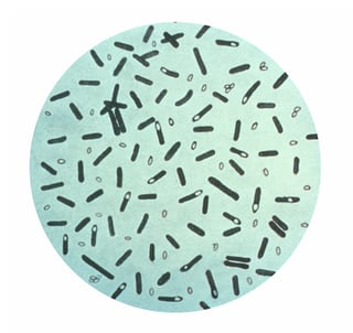 Picture of Clostridium
