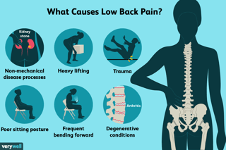 Picture of Low back pain