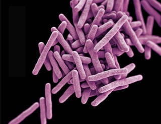 Picture of Mycobacterium