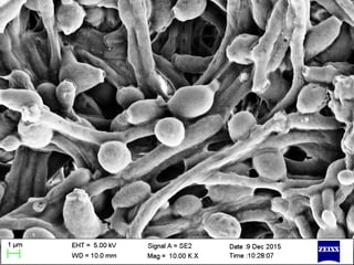 Picture of Candida albicans