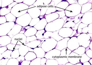 Picture of adipose tissue