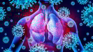 Picture of Disease