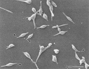 Picture of Mycoplasma pneumoniae
