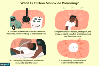 Picture of Carbon monoxide poisoning