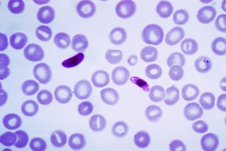 Picture of Plasmodium falciparum