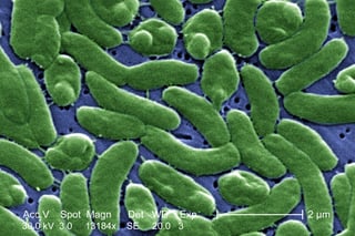 Picture of Vibrio vulnificus