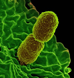 Picture of Klebsiella