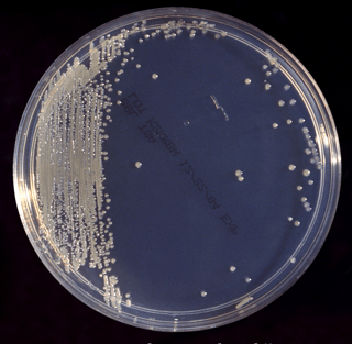 Picture of Cronobacter sakazakii
