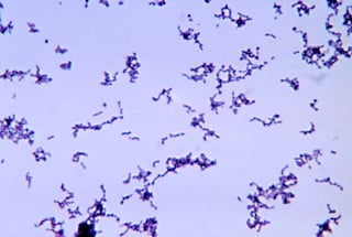 Picture of Cutibacterium acnes