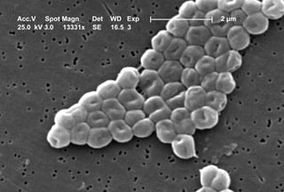Picture of Acinetobacter