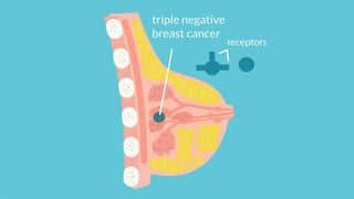 Picture of Triple-negative breast cancer