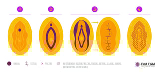 Picture of Female genital mutilation