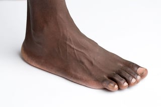 Picture of foot