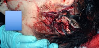 Picture of Gunshot