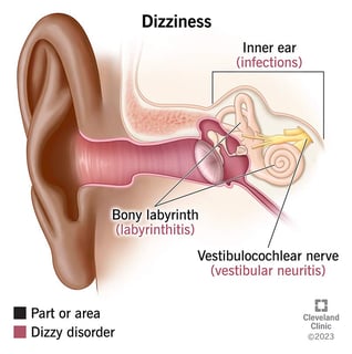 Picture of Dizziness