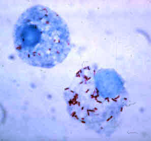 Picture of Rickettsia rickettsii