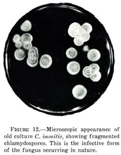 Picture of Coccidioides