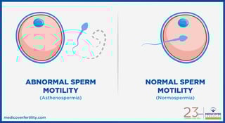 Picture of Sperm motility