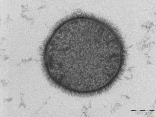 Picture of Hay bacillus