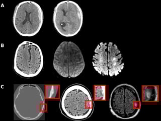 Picture of Post-traumatic amnesia
