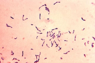 Picture of Corynebacterium