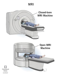 Picture of Magnetic resonance imaging