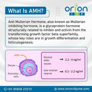 Picture of Anti-Müllerian hormone