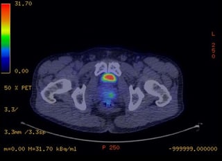 Picture of Positron emission tomography