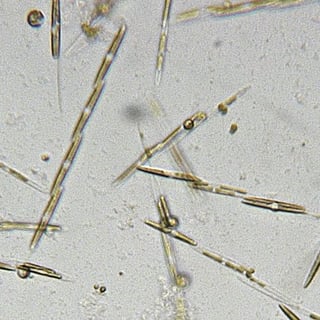 Picture of Pseudo-nitzschia
