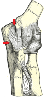 Picture of Ulnar collateral ligament of elbow joint