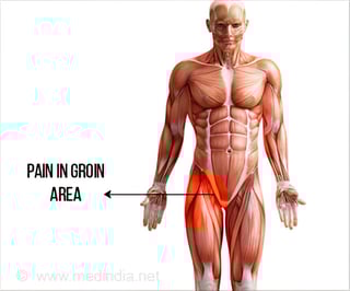Picture of groin