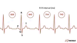 Picture of Heart rate variability
