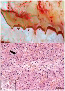 Picture of Elephant endotheliotropic herpesvirus