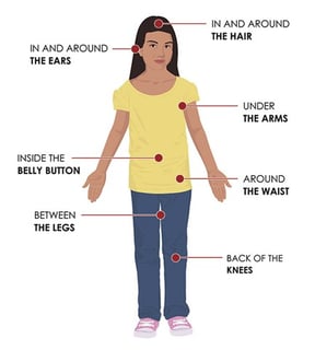 Picture of tick-borne encephalitis