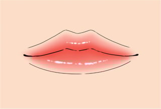 Picture of lip