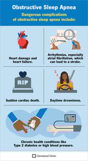 Picture of sleep apnea